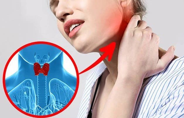 Đa nhân tuyến giáp có thể gây sưng hoặc đau thắt vùng cổ