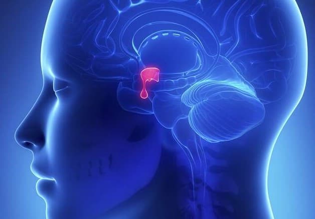 U tuyến yên được nhận định là một trong những loại u não điển hình 