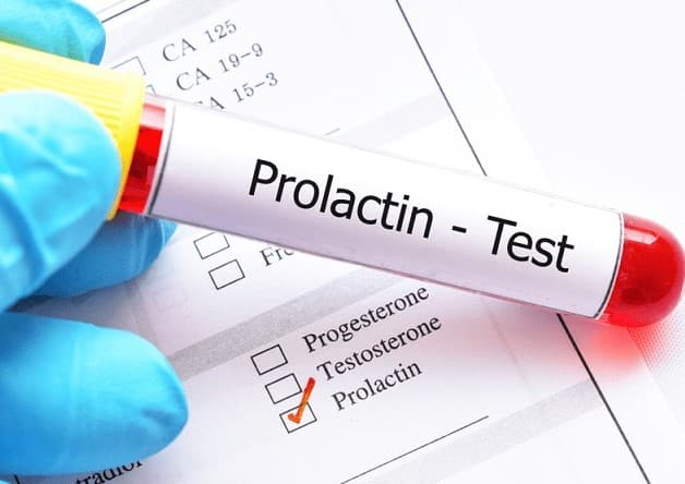 Tăng tiết Prolactin