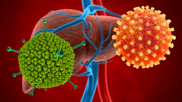 Nguyên nhân ung thư gan và cách phòng tránh