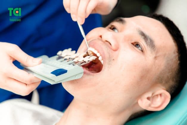 hở chân răng sứ