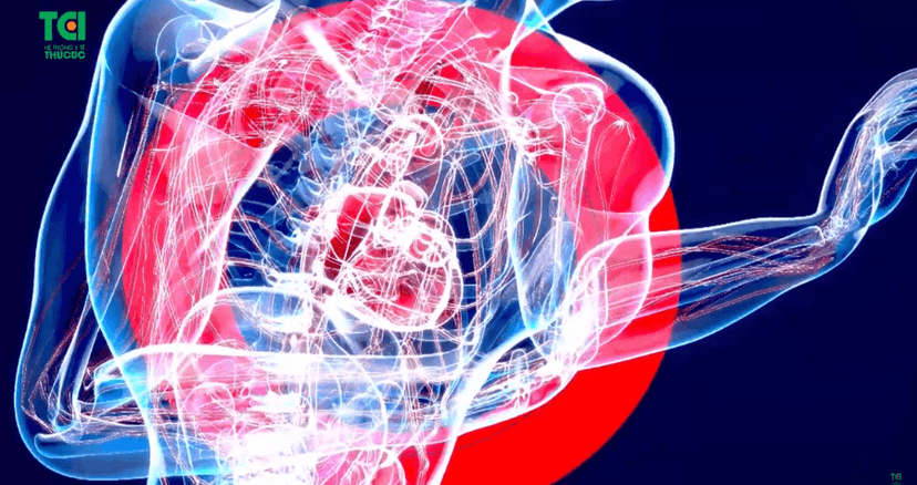 Hiểm họa nhồi máu cơ tim khi đau ngực trái đột ngột