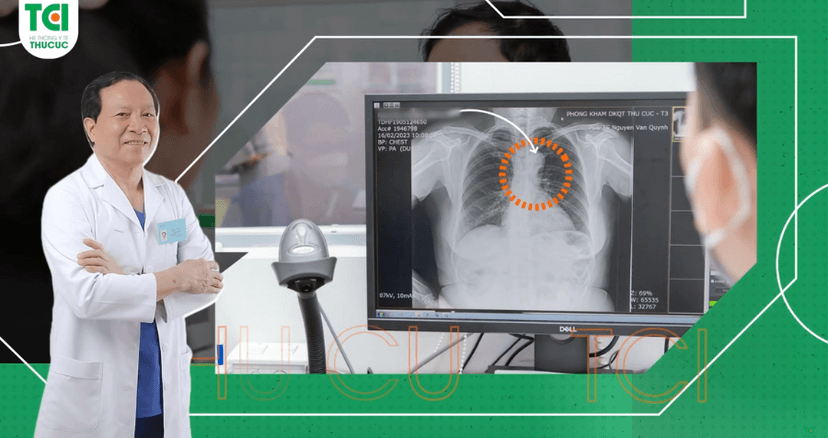 Đau tức ngực khi bị tăng huyết áp, cẩn trọng với quai động mạch chủ vồng