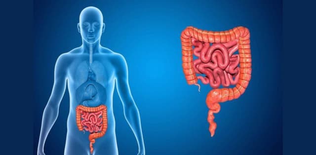 U GIST đại tràng: Nguyên nhân, triệu chứng và cách phòng ngừa