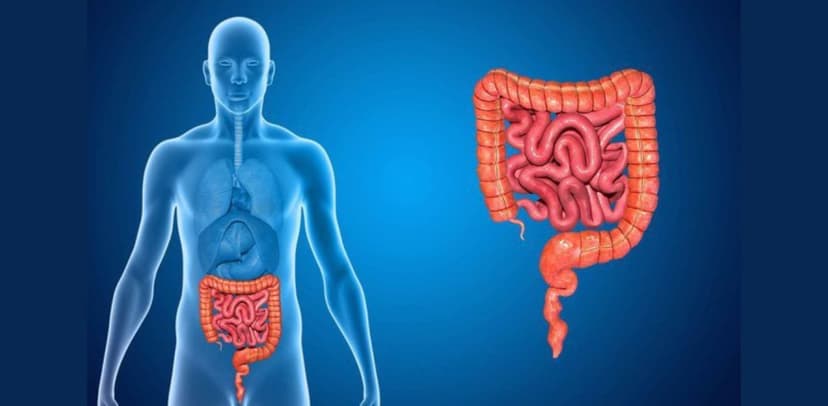 U GIST đại tràng: Nguyên nhân, triệu chứng và cách phòng ngừa