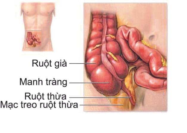 Vị trí ruột thừa trong cấu trúc ống tiêu hóa.