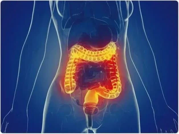 IBD là bệnh gì là câu hỏi rất nhiều người quan tâm