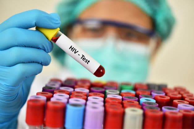 các bệnh lây truyền qua đường tình dục nguy hiểm