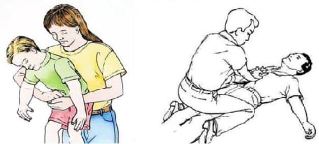 chữa hóc xương cá