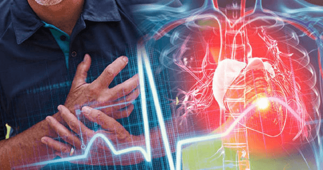 Đột quỵ nguyên nhân do tắc mạch từ tim là gì?