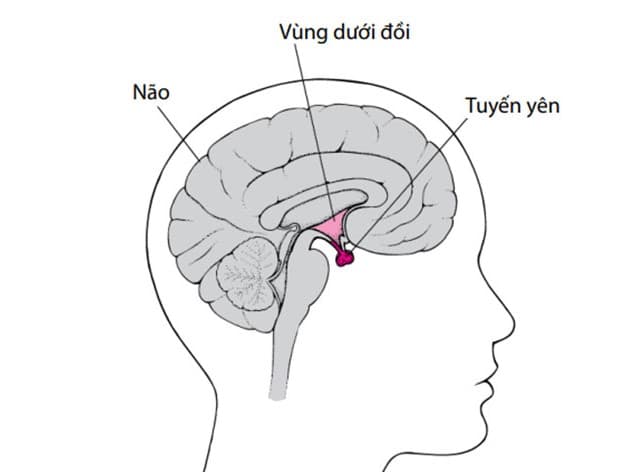 Dấu hiệu u tuyến yên 
