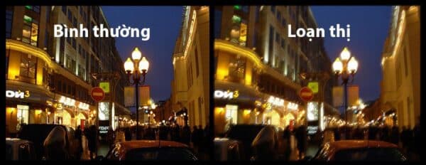 Nguyên nhân gây loạn thị