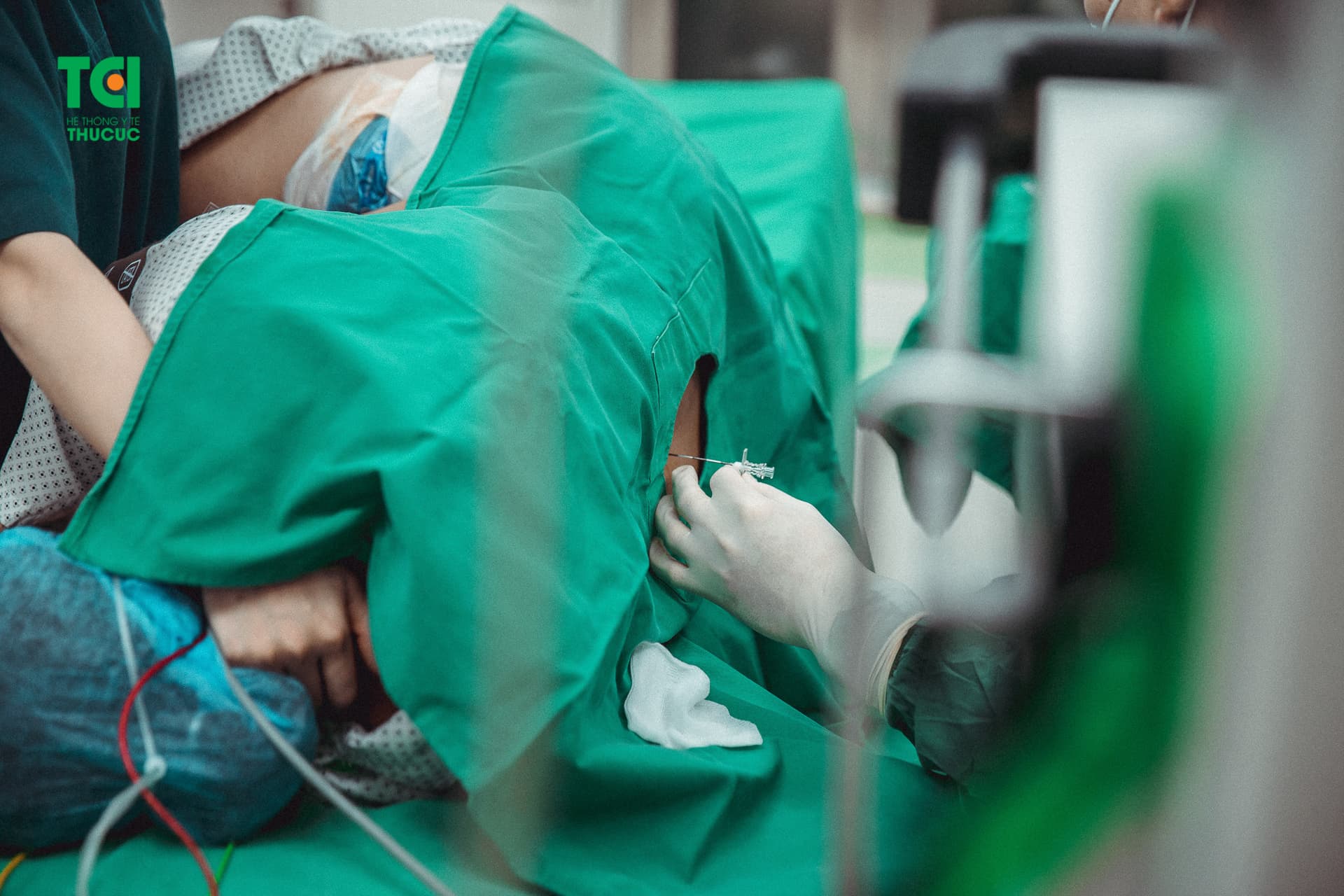 Lợi ích của gây tê ngoài màng cứng