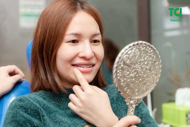 lưu ý về niềng răng mắc cài