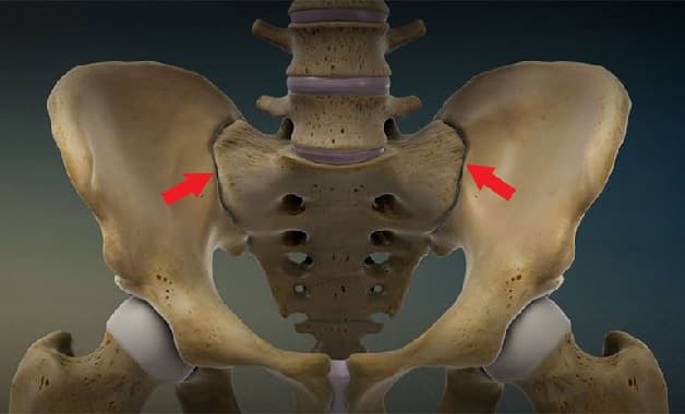 Viêm khớp cùng chậu là bệnh lý không có biểu hiện cụ thể