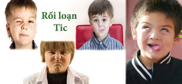 Rối loạn vận động tics