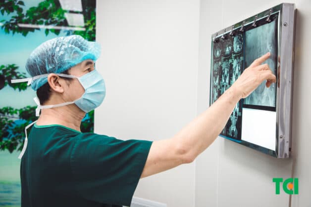 Lấy sạch 4 viên sỏi thận kích thước lớn trong 1 lần tán sỏi qua da