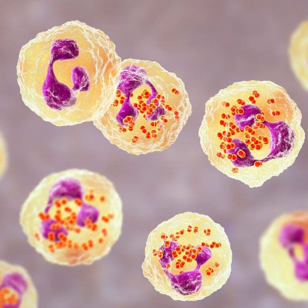 Tác hại của bệnh lậu và bệnh giang mai chớ nên bỏ qua