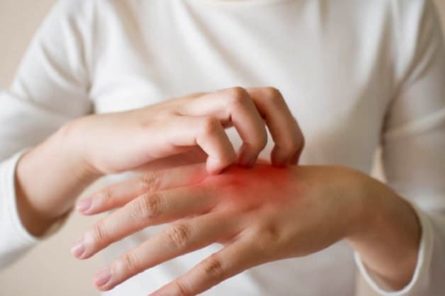 Ngứa ngáy là triệu chứng của gan nhiễm mỡ