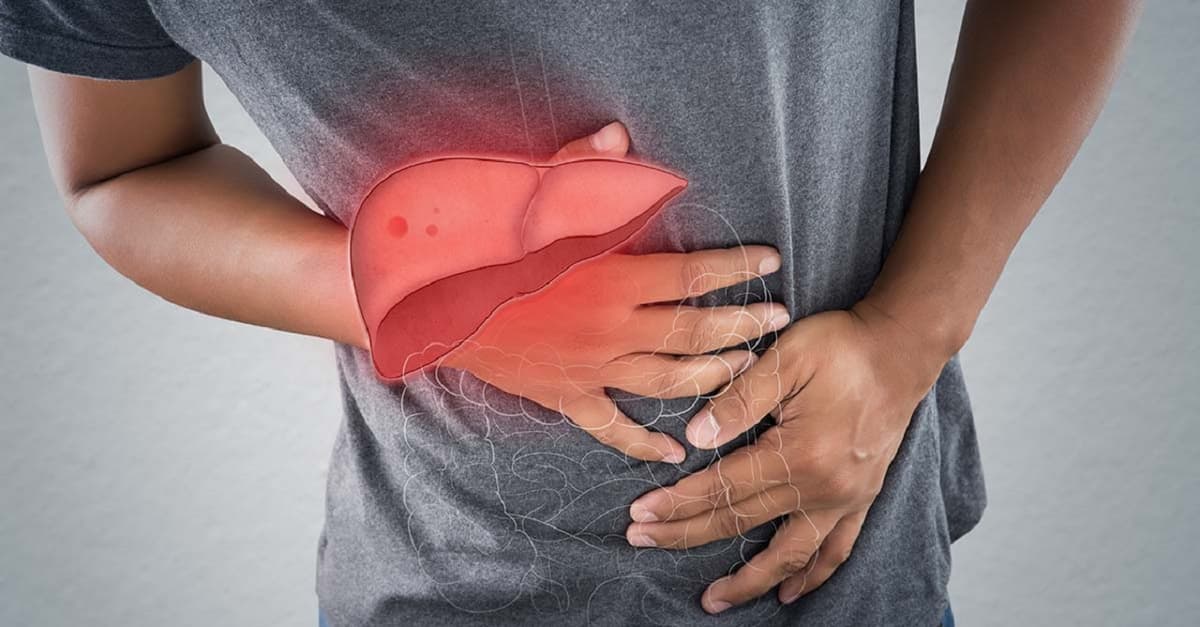 Triệu chứng bệnh ung thư gan điển hình cần lưu ý