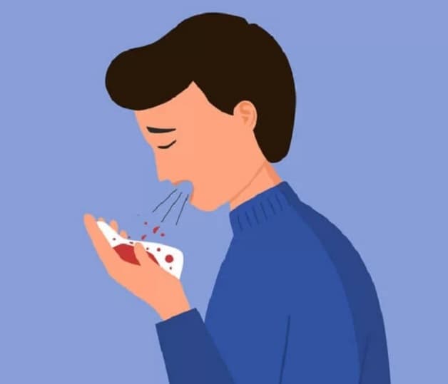 Tìm hiểu về bệnh ung thư phổi dạng không tế bào nhỏ