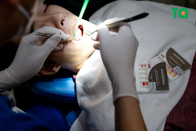 Tủy răng hoại tử và phương pháp điều trị