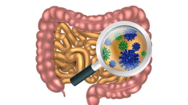 Nguyên nhân gây viêm ruột hoại tử ở người lớn có thể do nhiễm khuẩn