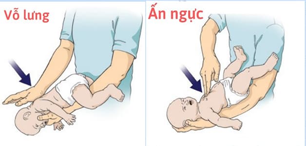 hóc xương cá ngậm vitamin C