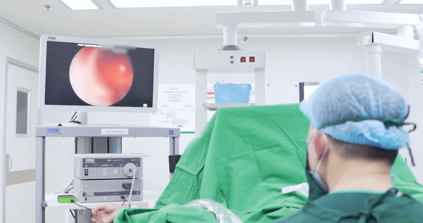 Quy trình tán sỏi nội soi ngược dòng không dao kéo chuẩn 5 sao tại TCI