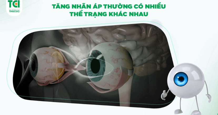 Bệnh tăng nhãn áp là gì? Đâu là cách điều trị hiệu quả?