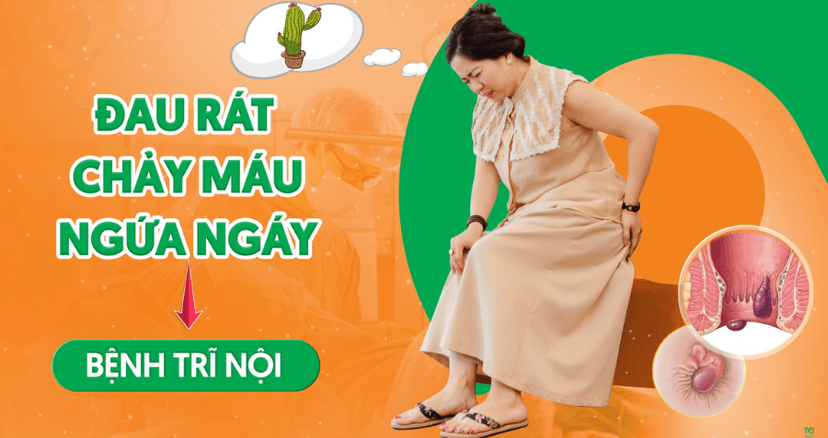 Bệnh trĩ nội: Điều trị ngay – Ngăn chặn biến chứng