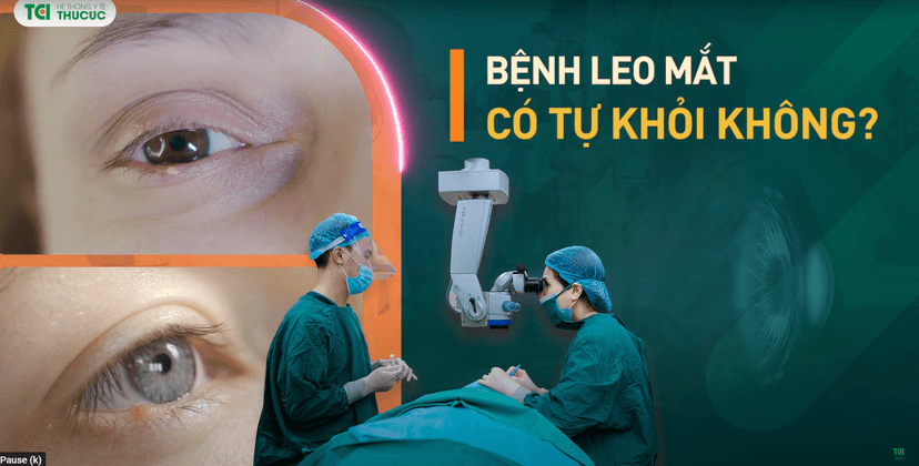 Giải đáp: Bệnh lẹo mắt có tự khỏi không?