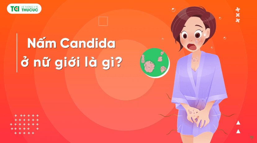 Biểu hiện nấm Candida ở nữ giới và cách xử trí