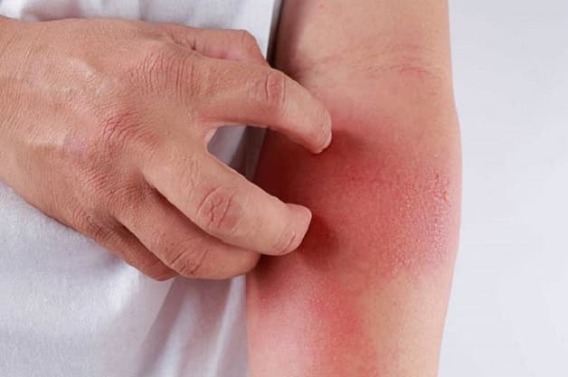 HIV là một trong những bệnh tình dục nguy hiểm