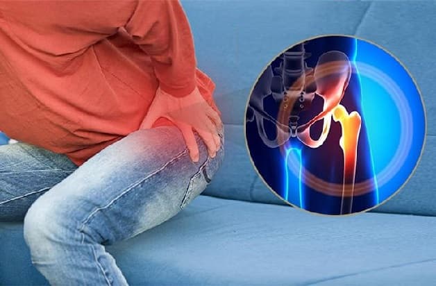 Chấn thương làm tăng nguy cơ thoái hóa khớp háng ở mọi lứa tuổi