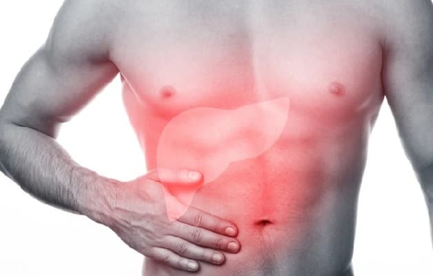 Gan nhiễm mỡ không do rượu là tình trạng nhiễm mỡ gan ở những người ít uống rượu bia