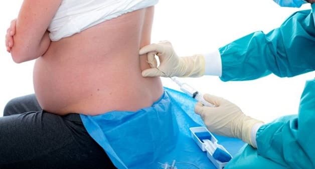 Gây tê ngoài màng cứng giúp giảm đau một cách đáng kể trong quá trình chuyển dạ