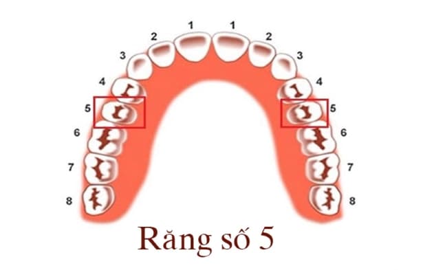 nhổ răng số 5