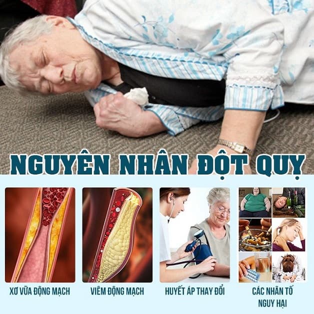 tăng huyết áp - nguyên nhân gây đột quỵ