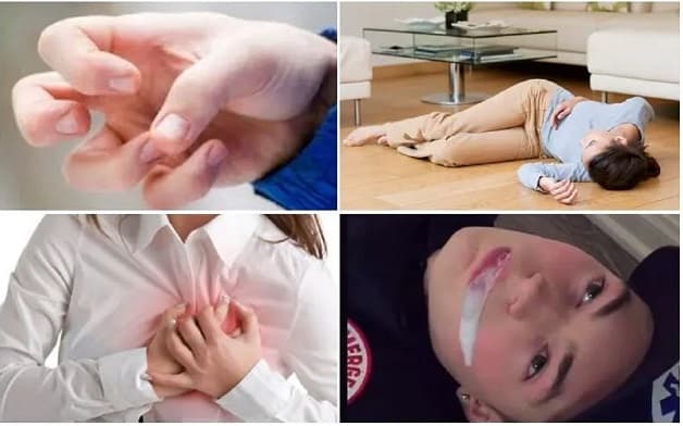 biểu hiện lên cơn động kinh