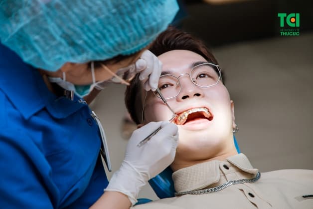 niềng răng cần cắt lợi