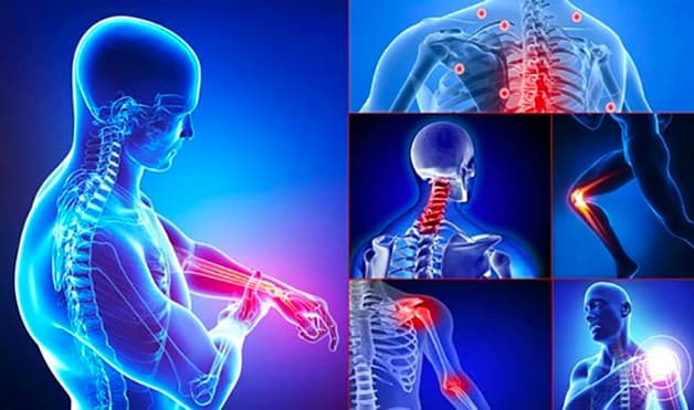 Người mắc bệnh thoái hóa khớp ngày càng trẻ hóa.