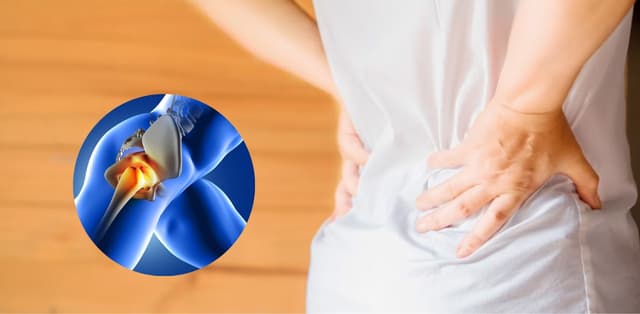 Cẩn trọng với thoái hóa khớp háng ở người trẻ