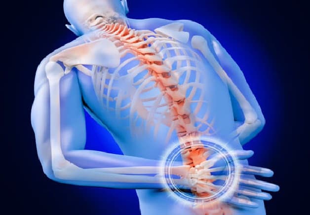 Một trong những triệu chứng chính của bệnh là đau vùng lưng.