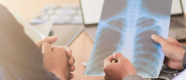 Điều trị bệnh ung thư phổi không tế bào nhỏ giai đoạn 2