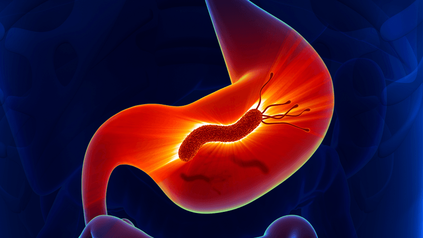 Vi khuẩn HP là gì? Những kiến thức không thể bỏ qua