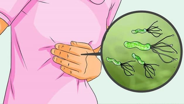 Vi khuẩn hp lây qua đường ăn uống