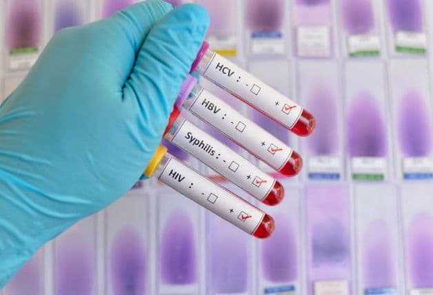 STDs là những bệnh lây qua đường tình dục