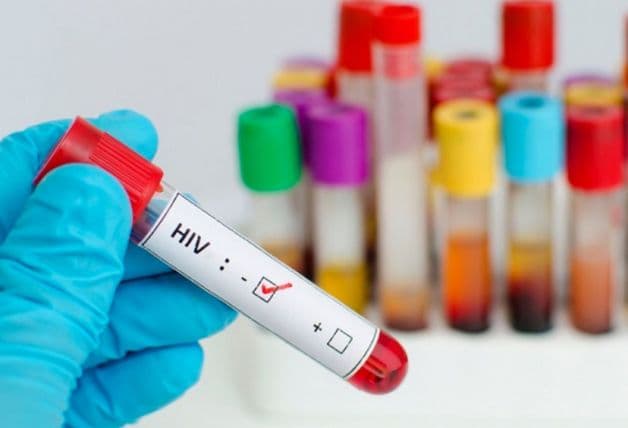 HIV thường không có triệu chứng cụ thể