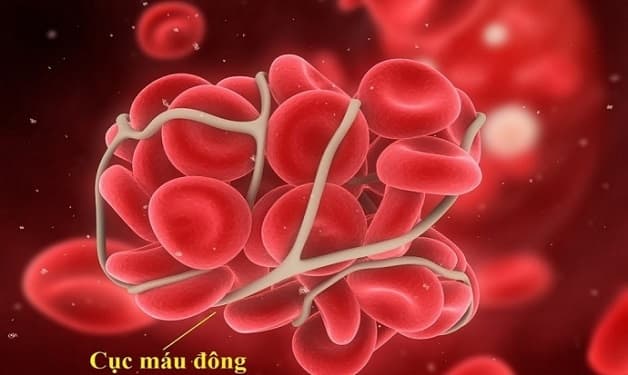 xơ gan hạ natri máu